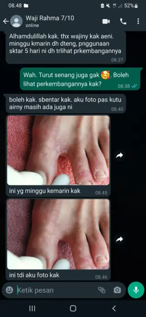 testi kutu air 3