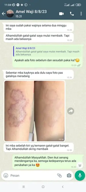 testi ruam